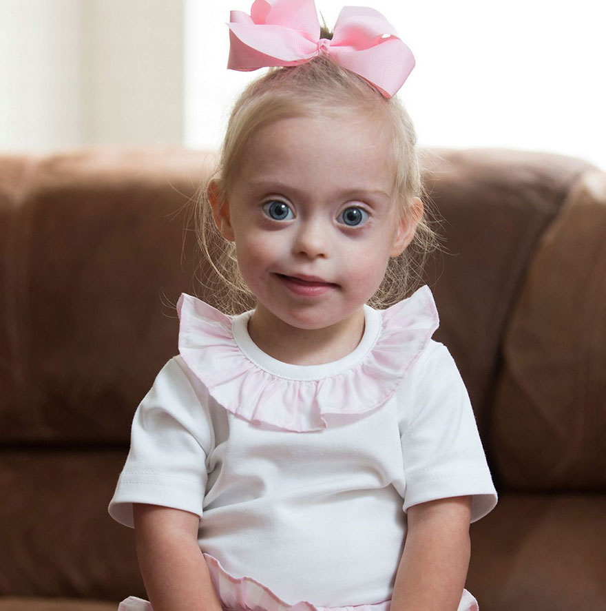 Bambina di 2 anni con Sindrome Down ottiene contratto da modella grazie al  suo sorriso