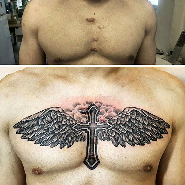 Tatuaggi cicatrici: 215 esempi di tatuaggi per coprire cicatrici con l'arte
