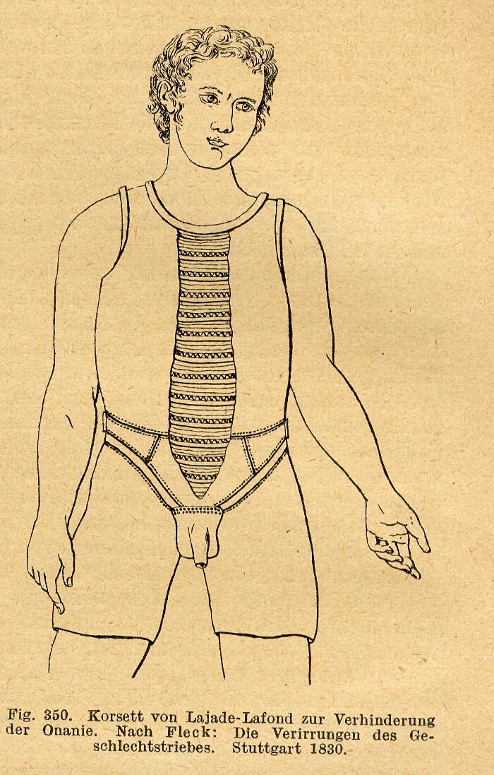 Candore maschile: la cintura di castità per uomini usata nel secolo scorso  per combattere la masturbazione