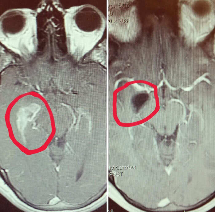 foto interessanti prima e dopo foto interessanti prima e dopo